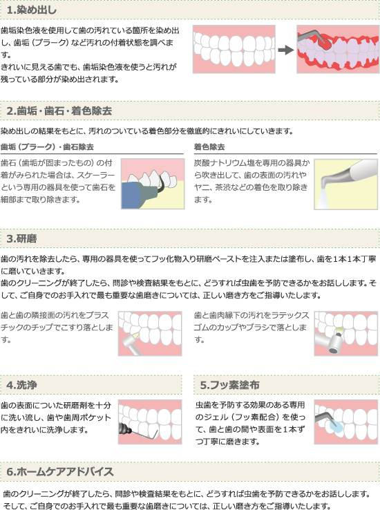 PMTCの流れ